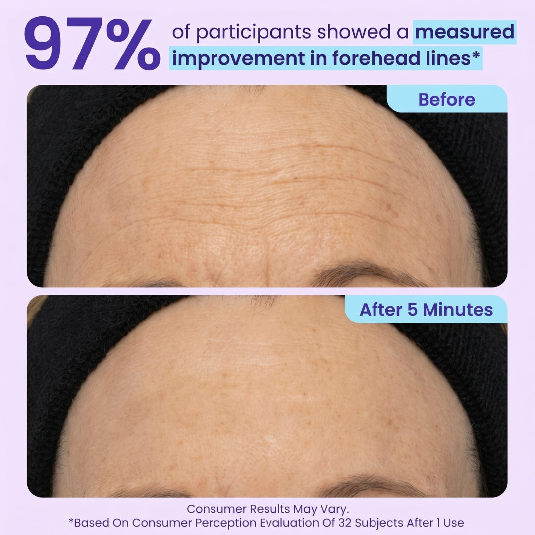 SPECIAL LAUNCH PRICE | GPURE™ Instant Lift Eye Gel | For Puffiness & Bags, Wrinkles, Fine Lines and Dark Circles