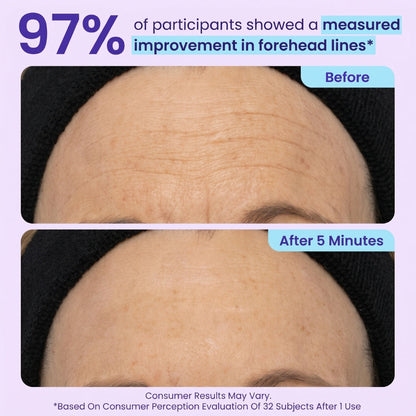 SPECIAL LAUNCH PRICE | GPURE™ Instant Lift Eye Gel | For Puffiness & Bags, Wrinkles, Fine Lines and Dark Circles