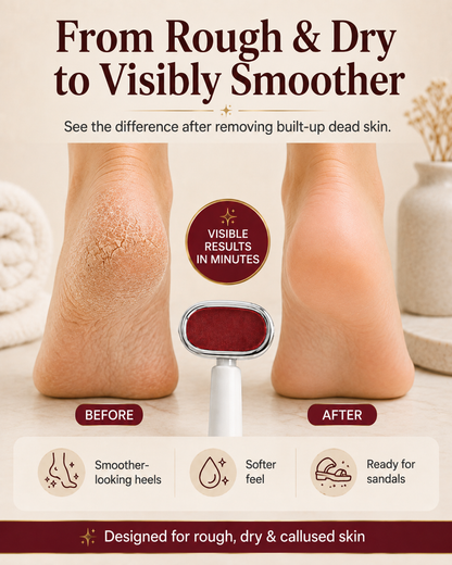 Foot Callus Remover for Rough, Dry Heels | At-Home Foot Care